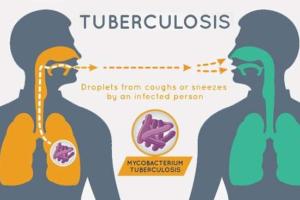 Dinkes Madiun Tangani 5 Ribu Lebih Penderita Tuberculosis