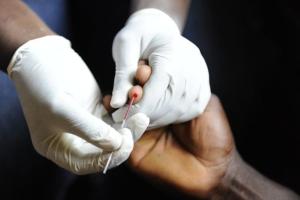 Rata-rata Ada 30 Penderita HIV/AIDS di Tulungagung Tiap Bulan 