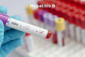 Virus Hepatitis B Lebih Ganas dari HIV